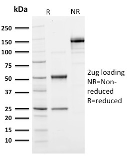 Data from SDS-PAGE analysis of Anti-Ubiquitin antibody (Clone UBB/1748). Reducing lane (R) shows heavy and light chain fragments. NR lane shows intact antibody with expected MW of approximately 150 kDa. The data are consistent with a high purity, intact mAb.